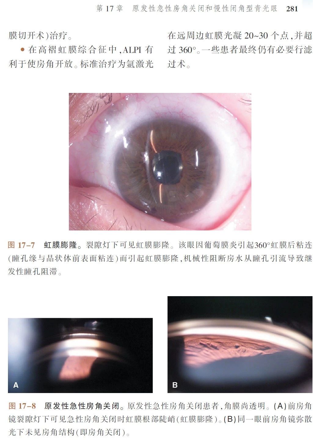 新书推荐 · 经典好书——《Wills 临床眼科彩色图谱及精要：青光眼》