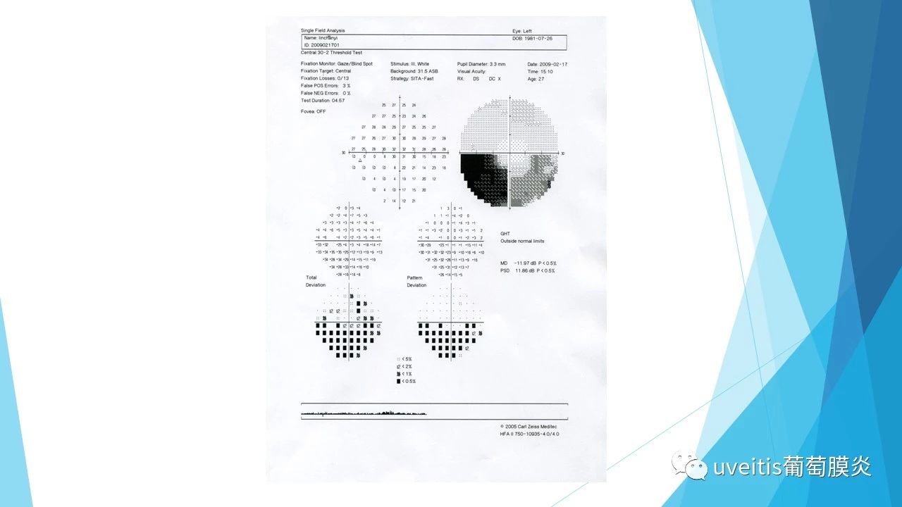 > 青光眼视野检查报告单