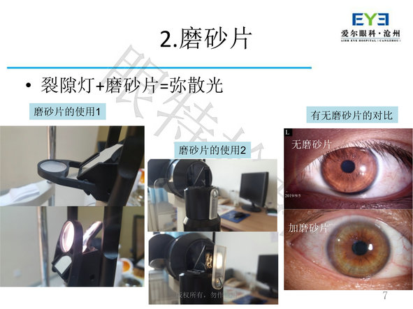 数码裂隙灯使用高阶教