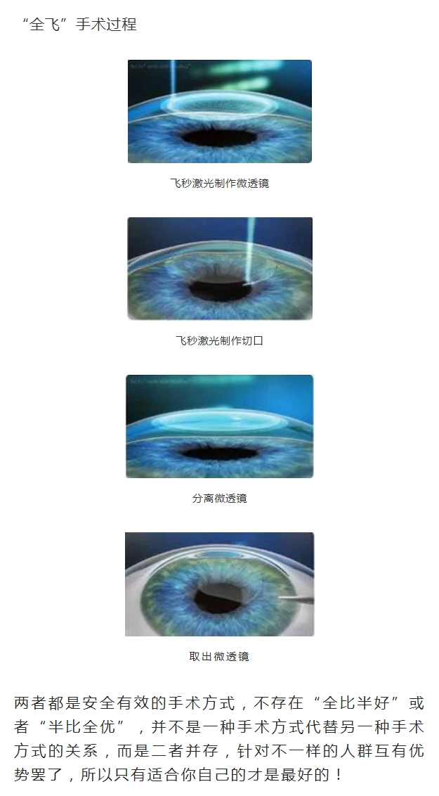 科普半飞秒和全飞