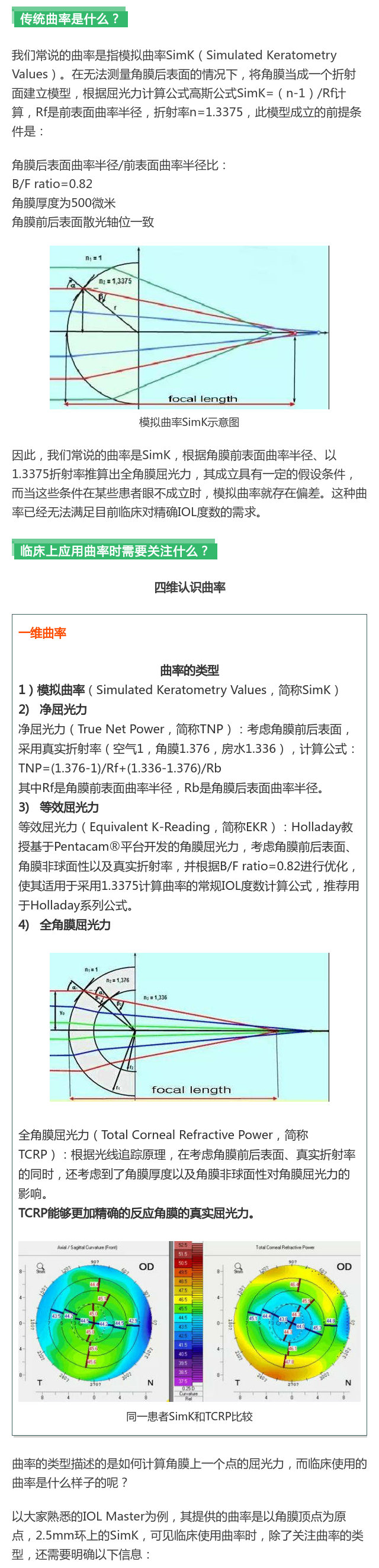 【曲率再认识】精确计算iol度数从认识角膜曲率开始_中国眼科网_www.